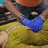 Gas Acidity Chiropractic Treatment By RKM Chiropractor