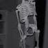 Skeleton On Fan Meme Remake