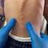 ChiropractorScoliosis Treatment Drrajneeshkant Rkm