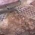 Laparoscopic Pectopexy Vs Sacropexy Along With TLH In 3rd Degree UV Prolapse