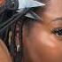 It Feels So Good To Touch My Scalp Again Bottom Left Of Video For Product Details