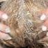 My Scalp Is So ITCHY Now