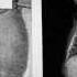The Shadow Of The Thalidomide Tragedy Retro Report The New York Times
