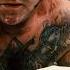 25 Surgeries To Remove His Neo Nazi Tattoos Erasing Hate