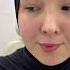 Dr Muxsin 998 88 172 44 44 Rinoplastika Natijalari Shorts Rhinoplasty Shortsvideo ринопластика