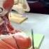 PNS Video 6