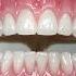 Checking The Bite Lsk121shorts Dentist Teeth