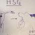 Just The FAQs The HSG Hysterosalpingogram