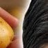 Hair Grows Like Crazy And Stops Falling Out Most Powerful Natural Recipe