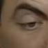 Mr Bean At The Dentist