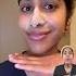 How To Get Rid Of Blackheads And Sebaceous Filaments Skincaretips