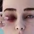 Bees In A Woman S Eye