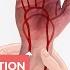 Modified Allen Test Clinical Examination