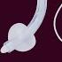 Understanding Tracheostomy Tubes Essential Guide For Medical Professionals