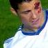 Teen Ager Messi Ronaldo Injured Real Madrid Barcelona 3 2 Imaginary Match Youtube Shorts