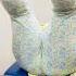 Tail Bone Pain Treatment Gemspineclinic Shortsfeed Shorts Yt