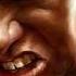 Aaron Cruey She Broke My Heart I Broke Her Jaw