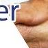 Anterior Drawer Test Of The Ankle Chronic Ankle Laxity Anterior Talofibular Ligament Rupture