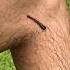 COVERED IN LEECHES