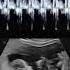 This Is What A Baby S Heartbeat Sounds Like During An Ultrasound Science Natal Shorts