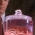 Dr Hfuhruhurr Meets Ann Uumellmahaye The Man With Two Brains