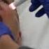 Nutrition Focused Physical Exam