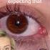 What S Coming Out Of Her Eye