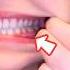 The Secret To Whiter Teeth In 20 Seconds