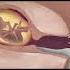 Abortion Is Not A Valid Choice Killing A Child Is Wrong