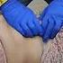 Chiropractor Massage Physiotherapy Live Doctor Rkm