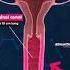 How Long Is The Vaginal Canal