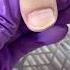 How To Fix Wide Thumb Nails