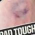 BEANED By 98 Mph TWICE IN ONE AT BAT