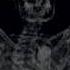 BONES OXYGEN Lyrics