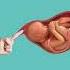 Getting A Membrane Sweep Laboranddelivery Childbirtheducation