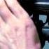 Thule Hitch Ski 987xt Demonstrated By Rack Attack
