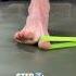 HOW TO FIX Flat Feet Plantar Fasciitis Dropped Arch And Over Pronation