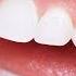 Healthy Teeth And Gums Subliminal Affirmations