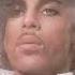Prince 1999 Audio