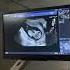 This Is A Baby At 12 Weeks In The Womb