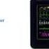 Philips IntelliVue MX400 Patient Monitor Sales Service Repair Exchange Replacement