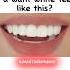 Do You Want White Teeth Like This Shorts Viral Whiteteeth Trending Glowup Fypシ Aesthetic