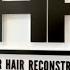 Dr Felix Hair Implant No 1 Hair Transplant Clinic In Eastern Europe