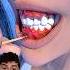 Gum Color Meaning Dentist Explained