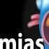 Cardiac Arrhythmias Animation