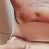 How To Check For Pedal Odema Edema Leg Swelling Shorts Edema Swelling