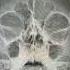 PNS WATER VIEWS Pa Xray Xray Radiology Viral Viral Suscribe Viralvideo Youtubeshort