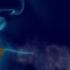 Anti Smoking Ad Smoking Causes Emphysema Lung Cancer Shorts