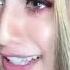 Phone Recording My Phone Bigo Live Video Call IMO Live Video Call Skype Video Call 78