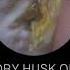 DRY EAR WAX HUSK REMOVAL